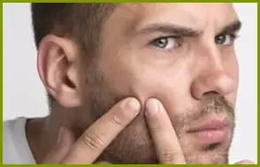 Composto auxiliar no tratamento da acne